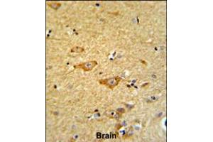Formalin-fixed and paraffin-embedded human brain reacted with OMD Antibody , which was peroxidase-conjugated to the secondary antibody, followed by DAB staining. (Osteomodulin Antikörper  (AA 234-263))