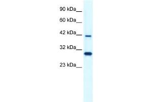 WB Suggested Anti-PREB Antibody Titration:  0.