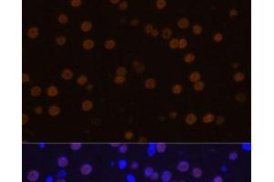 Immunofluorescence analysis of Mouse brain using MEF2C Polyclonal Antibody at dilution of 1:100 (40x lens). (MEF2C Antikörper)