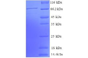 SDS-PAGE (SDS) image for Phosphoglycerate Kinase 1 (PGK1) (AA 25-417), (partial) protein (GST tag) (ABIN7479251) (PGK1 Protein (AA 25-417, partial) (GST tag))