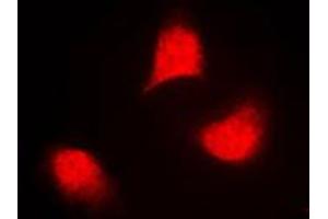 Immunofluorescent analysis of MKK4 (pT261) staining in NIH3T3 cells.