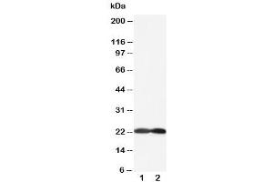 Western blot testing of BAK antibody and Lane 1:  HeLa