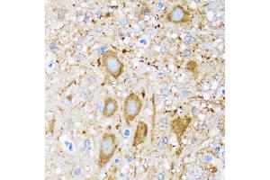 Immunohistochemistry of paraffin-embedded mouse spinal cord using HSPH1 antibody. (HSPH1 Antikörper)