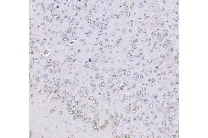 IHC analysis of Optineurin using anti-Optineurin antibody (ABIN3042498).