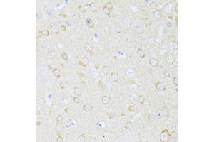 Immunohistochemistry of paraffin-embedded rat brain using MAP1LC3B antibody. (LC3B Antikörper)