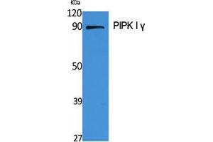 Western Blot (WB) analysis of specific cells using PIPK I gamma Polyclonal Antibody. (PIPK I gamma (Internal Region) Antikörper)