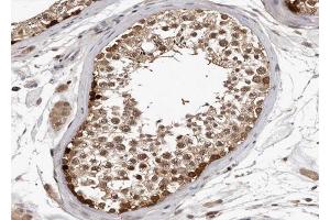 ABIN6267003 at 1/100 staining human Testis tissue sections by IHC-P. (HSP90AA1 Antikörper  (C-Term))