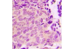 Immunohistochemistry (IHC) image for anti-Tuberous Sclerosis 2 (TSC2) (pSer939) antibody (ABIN7301412)