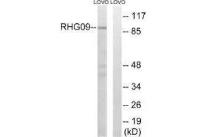 Western blot analysis of extracts from LOVO cells, using RHG9 antibody. (ARHGAP9 Antikörper)