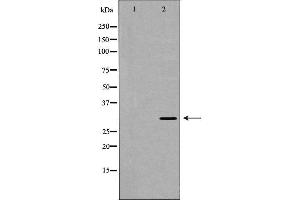 Western blot analysis of extracts of PC-3, using TOLLIP antibody. (TOLLIP Antikörper  (Internal Region))