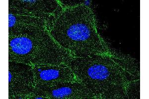 Immunofluorescence (IF) image for anti-Actin, beta (ACTB) (AA 1-50) antibody (ABIN724340)