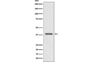 Western blot analysis of AMPK beta 1 expression in HeLa cell lysate.