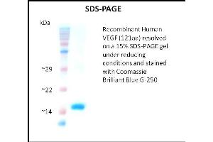 SDS-PAGE (SDS) image for Vascular Endothelial Growth Factor (VEGF) (Active) protein (ABIN5509529)