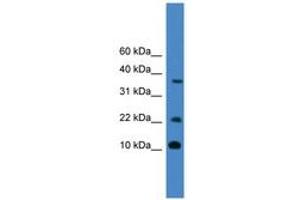 Image no. 1 for anti-Caspase 4, Apoptosis-Related Cysteine Peptidase (CASP4) (AA 211-260) antibody (ABIN6745371) (Caspase 4 Antikörper  (AA 211-260))