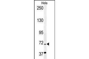 RAD26 Antibody (N-term) (ABIN654126 and ABIN2844001) western blot analysis in Hela cell line lysates (35 μg/lane). (ERCC6 Antikörper  (N-Term))