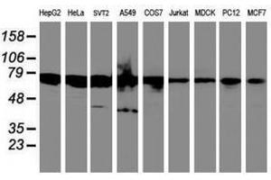 Image no. 4 for anti-serine Peptidase Inhibitor, Kunitz Type 1 (SPINT1) antibody (ABIN1501109) (SPINT1 Antikörper)