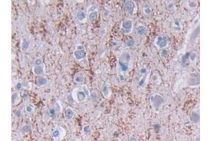 Detection of TDH in Human Cerebrum Tissue using Polyclonal Antibody to L-Threonine Dehydrogenase (TDH) (Tdh Antikörper  (AA 1-229))