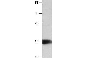 Western Blot analysis of Mouse kidney tissue using NME3 Polyclonal Antibody at dilution of 1:800 (NME3 Antikörper)