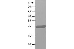 Western Blotting (WB) image for Glutathione S-Transferase, pi 2 (GSTP2) (AA 1-210) protein (His tag) (ABIN7123152) (GSTP2 Protein (AA 1-210) (His tag))