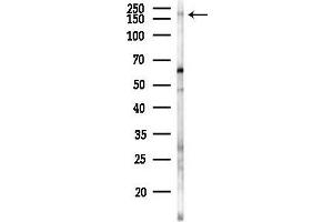 anti-Low Density Lipoprotein Receptor-Related Protein 6 (LRP6) (pSer1420) antibody