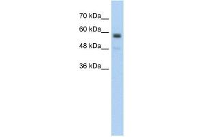 WB Suggested Anti-C9orf127 Antibody Titration:  5. (TMEM8B Antikörper  (Middle Region))