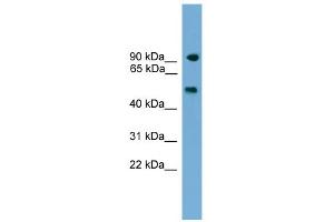 WB Suggested Anti-Parp8 Antibody Titration: 0. (PARP8 Antikörper  (C-Term))