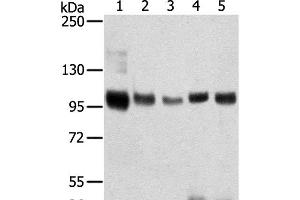 Western Blot analysis of Mouse brain and Human brain tissue, Human prostate tissue, Human fat and placenta tissue using SORT1 Polyclonal Antibody at dilution of 1:200 (Sortilin 1 Antikörper)