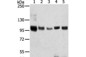 Western Blot analysis of Mouse brain and Human brain tissue, Human prostate tissue, Human fat and placenta tissue using SORT1 Polyclonal Antibody at dilution of 1:200