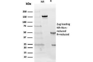 SDS-PAGE Analysis Purified Follistatin Mouse Monoclonal Antibody (FST/4281).