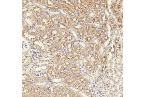 Immunohistochemistry (IHC) image for anti-Transforming Growth Factor, beta Receptor 1 (TGFBR1) (pSer165) antibody (ABIN7193143)