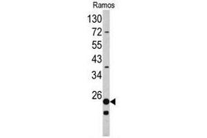 Western blot analysis of RPS9 antibody (C-term) in Ramos cell line lysates (35ug/lane). (RPS9 Antikörper  (C-Term))