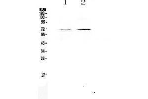 Western blot analysis of CLPX using anti-CLPX antibody . (CLPX Antikörper  (AA 337-574))