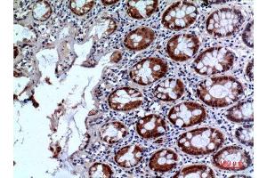 Immunohistochemistry (IHC) image for anti-Interleukin 1 Receptor, Type II (IL1R2) (Internal Region) antibody (ABIN6281356)