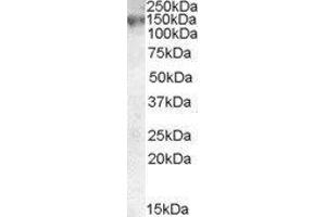 Western Blotting (WB) image for ATP-Binding Cassette, Sub-Family C (CFTR/MRP), Member 1 (ABCC1) peptide (ABIN369197) (ATP-Binding Cassette, Sub-Family C (CFTR/MRP), Member 1 (ABCC1) Peptid)