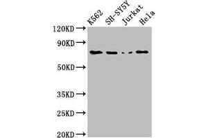 Western Blot Positive WB detected in: K562 whole cell lysate, SH-SY5Y whole cell lysate, Jurkat whole cell lysate, Hela whole cell lysate All lanes: PRKCB antibody at 3 μg/mL Secondary Goat polyclonal to rabbit IgG at 1/50000 dilution Predicted band size: 77, 78 kDa Observed band size: 77 kDa (PKC beta Antikörper  (AA 517-643))