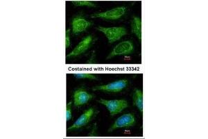 ICC/IF Image Immunofluorescence analysis of methanol-fixed HeLa, using c-Yes, antibody at 1:200 dilution.