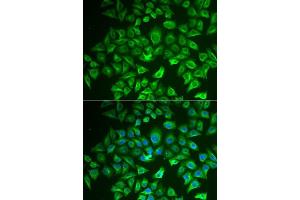 Immunofluorescence analysis of A549 cells using EHHADH antibody. (EHHADH Antikörper  (AA 444-723))