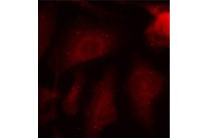 Immunofluorescence staining of methanol-fixed HeLa cells using Phospho-MAPT-S404 antibody (ABIN2987503). (MAPT Antikörper  (pSer404))