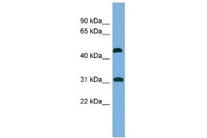 WB Suggested Anti-CTDSP2 Antibody Titration: 0.