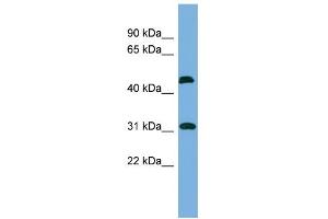 WB Suggested Anti-CTDSP2 Antibody Titration: 0. (CTDSP2 Antikörper  (N-Term))