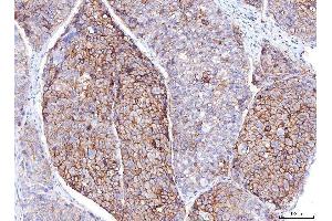 IHC analysis of Poliovirus Receptor/PVR using anti-Poliovirus Receptor/PVR antibody (ABIN7601071). (Poliovirus Receptor Antikörper  (AA 28-331))