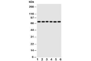 Western blot testing of Splicing factor 1 antibody and Lane 1:  rat spleen;  2: rat liver;  3: PANC;  4: COLO320;  5: SW620;  6: SKOV cell lysate (Splicing Factor 1 Antikörper  (N-Term))