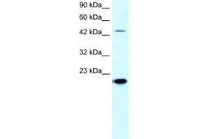 MMP19 antibody used at 5-10 ug/ml to detect target protein. (MMP19 Antikörper  (C-Term))