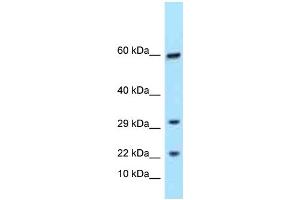 Western Blotting (WB) image for anti-T Cell Receptor gamma Variable 9 (TRGV9) (C-Term) antibody (ABIN2788572) (TRGC1 Antikörper  (C-Term))