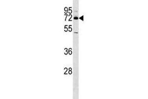 Western Blotting (WB) image for anti-Nuclear Receptor Subfamily 4, Group A, Member 2 (NR4A2) (AA 13-42) antibody (ABIN3032065)