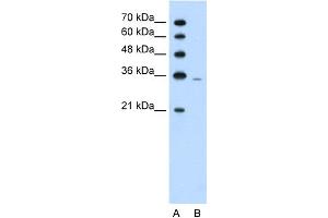 WB Suggested Anti-PRPS2 Antibody Titration:  1. (PRPS2 Antikörper  (Middle Region))