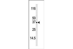 Image no. 1 for anti-BCL2-Interacting Killer (Apoptosis-Inducing) (BIK) (pThr33) antibody (ABIN358090) (BIK Antikörper  (pThr33))