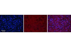 Rabbit Anti-MASP2 Antibody      Formalin Fixed Paraffin Embedded Tissue: Human Adult Liver   Observed Staining: Cytoplasm in hepatocytes, weak signal, wide tissue distribution   Primary Antibody Concentration: 1:100  Secondary Antibody: Donkey anti-Rabbit-Cy3  Secondary Antibody Concentration: 1:200  Magnification: 20X  Exposure Time: 0.