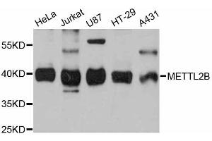 Western blot analysis of extracts of various cell lines, using METTL2B antibody (ABIN5998218) at 1:3000 dilution. (METTL2B Antikörper)