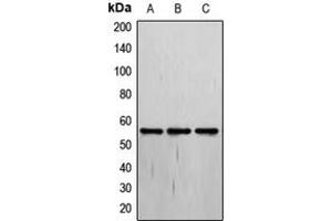 Western blot analysis of THRA expression in MCF7 (A), Jurkat (B), HepG2 (C) whole cell lysates.